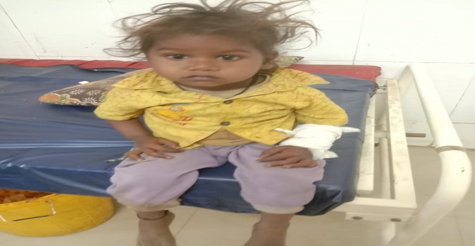 15 children were terrorized by a rabid dog in Sukhsar village