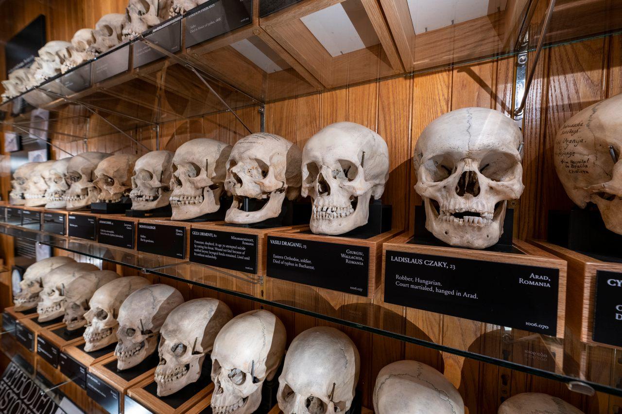 The skulls of thousands of slaves are still kept in this country, know why they have been preserved